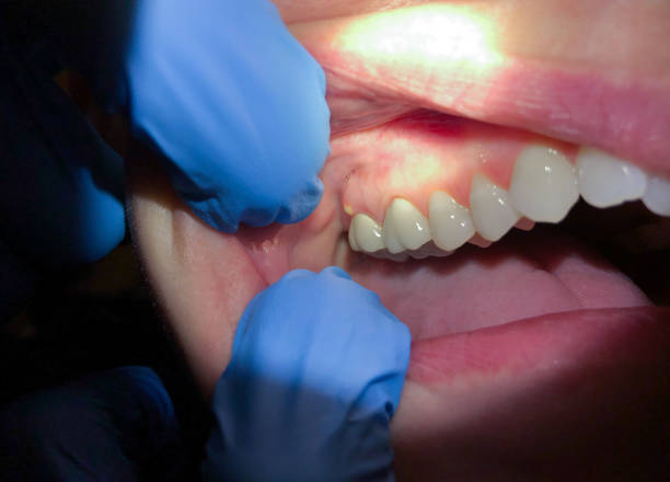 Best Tooth Infection Emergency Dentist  in , OR
